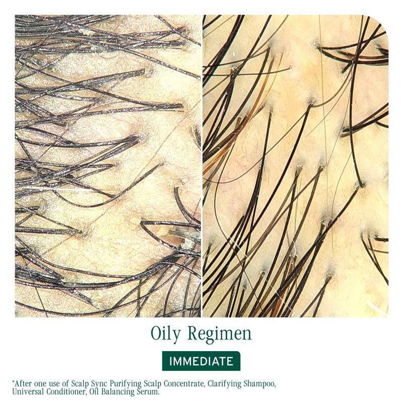 Biolage Scalp Sync Clarifying Shampoo 400ml