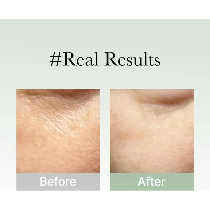 Suero De Máscara Facial Coreano Antienvejecimiento, Arencia