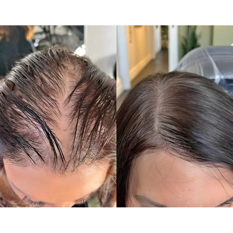 Shampoo Reviving Farmasi Caida Cabello