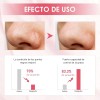 // D 1 Mascarilla De Arcilla Poromizante De Acción Rápida,