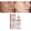 Sérum Facial Jaysuing Antiacné Niacinamida 5% 30ml Rostro