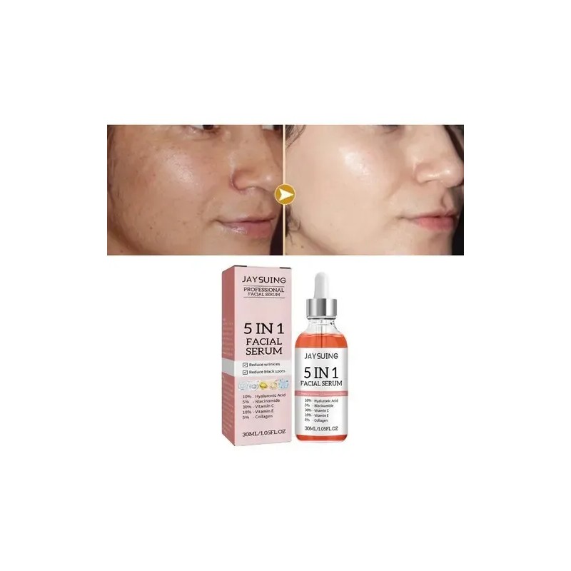 Sérum Facial Jaysuing Antiacné Niacinamida 5% 30ml Rostro