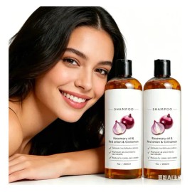2pzs Shampoo Con Cebolla Y Aceite De Romero Fortalece, Nutre Y Ayuda Al Crecimiento Del Cabello, Anticaída Y Reparación Capilar Solaura               