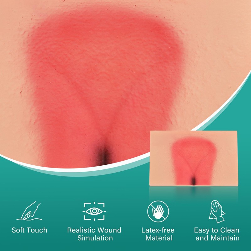 MedEduQuest Decubitus Ulcer Wound Care Model, Bedsores Model, Pressure Injury