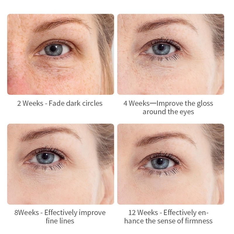 Arbutin Eye Cream Hydrating Remove Eye Bag VC Brightening Dark