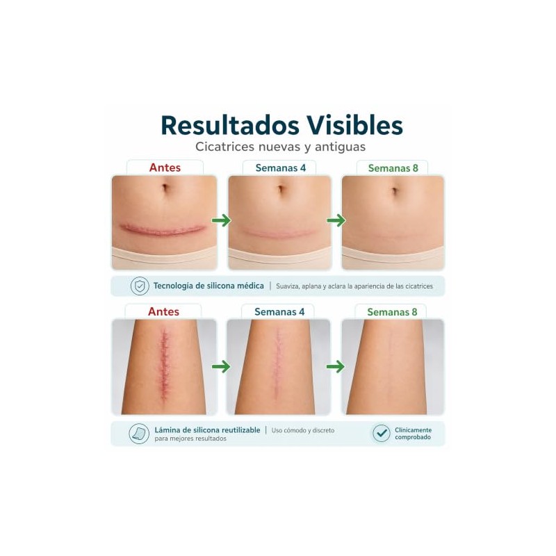 Parches Silicona Cicatrices Láminas Reutilizables Cesárea Acné