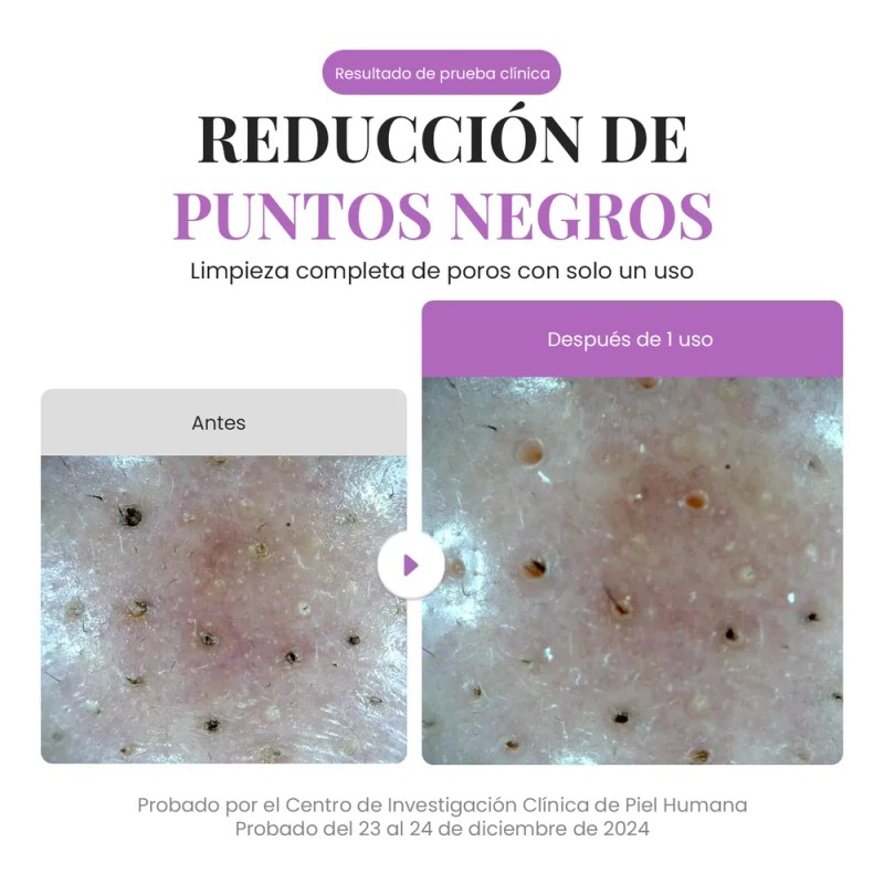 Eqqualberry Purple Rice Pore Purifying Limpiador Facial