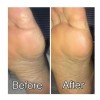 Spaesthetic Urea Al 30% En Gel-crema Hidratante 500 Ml