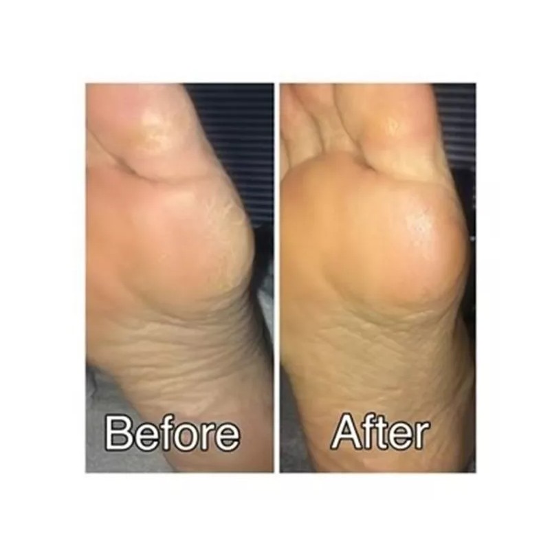 Spaesthetic Urea Al 30% En Gel-crema Hidratante 500 Ml