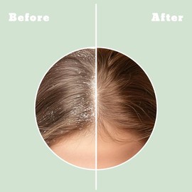 ALFHEIM Rosemary Leave-In Conditioner Spray Heat Protection Locks Moisture Adds Shine With Peppermint Rosemary Perfect For Blow-Dry Styling Long-Lasting Care