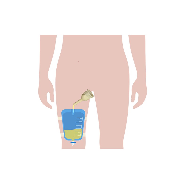 5 Male Urinal Bag Pee Bag Replacement Leg Bag for