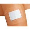 CURAPOR Transparent 10 x 15 cm Surgical Wound Dressing, Sterile,