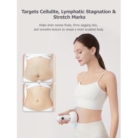 Handheld Body Massager for Legs & Belly - Lymphatic Drainage & Anti Cellulite Tool with Heat, Vibration - Electric Sculpting Machine Reduces Stretch Marks + Cellulite White Detox Gift