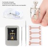 Ingrown Toenail Correction Patch Ingrown Nail Corrector Nail Insert Buckle