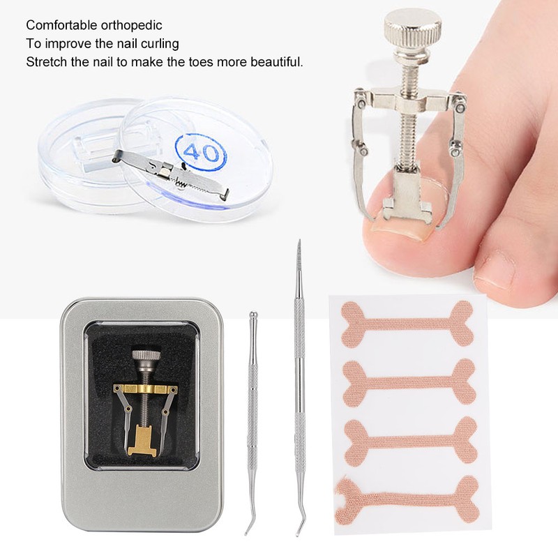 Ingrown Toenail Correction Patch Ingrown Nail Corrector Nail Insert Buckle