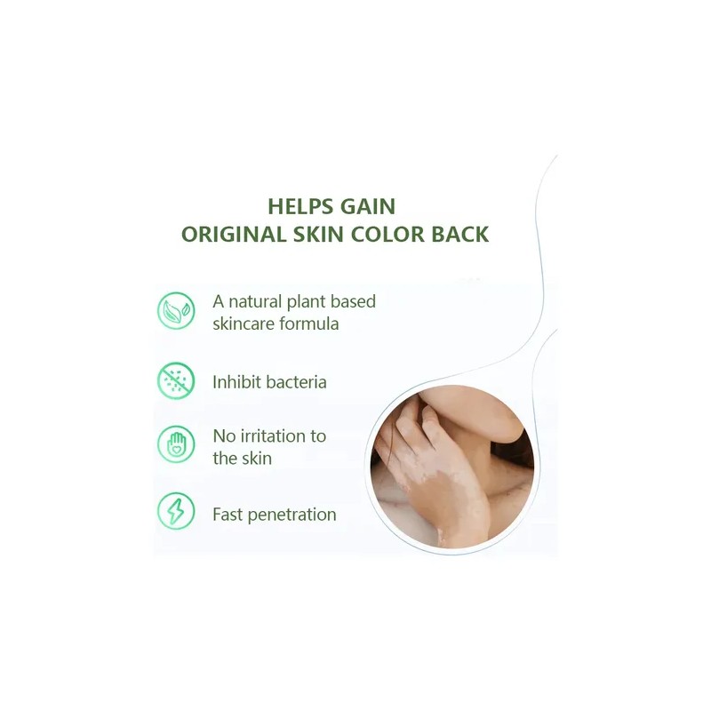 3 Cremas Vitiligo Tratamiento Profesional Sumifun