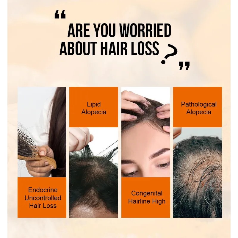 P Suero Natural For El Crecimiento Del Cabello Para