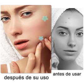 CHENGBAO 400 Pack Parches para acné,Parches de Estrellas para Acne,Estrellitas para Los Granos,Espinillas para el Cuidado de la Piel