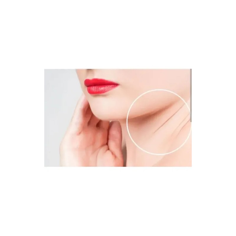 Crema\gel Tratamiento P Cuello Caido Gordo Papada Flacides