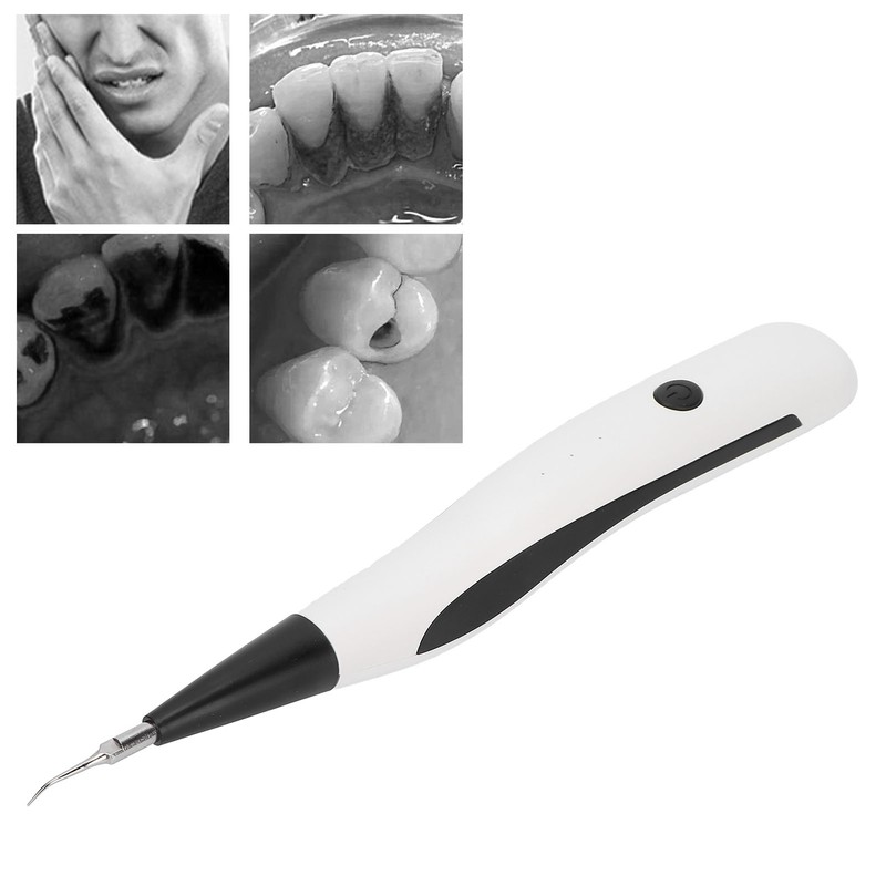 Electric Dental Calculus Remover Portable Oral Calculus Remover Teeth Cleaning