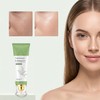 Gel Exfoliante Facial Té Verde Triple Enzima Peeling Suave Rostro