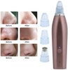 Rechargeable Electric Blackhead Removal Machine Vacuum Suction Face Pore CleanerChampagne