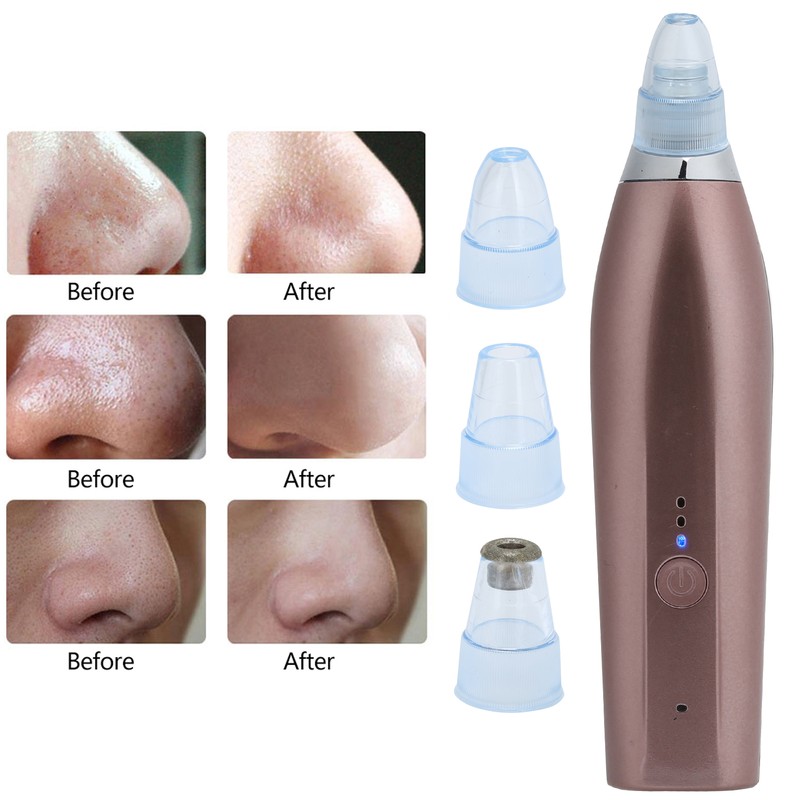 Rechargeable Electric Blackhead Removal Machine Vacuum Suction Face Pore CleanerChampagne