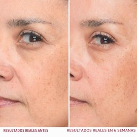 It Cosmetics Bye bye lines, Serum, Suero con Ácido Hialurónico, Reafirma Visiblemente la Piel y Suaviza las Líneas en 2 Semanas, Con Péptido + Vitamin