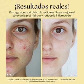 Sérum Coreano de Baba de Caracol Luxiena - 96% Mucina de Caracol | Reparación e Hidratación Profunda para una Piel Radiante | 100 ml