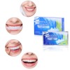 14-Pack: Advanced Teeth Whitening Strips
