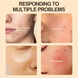 2Pcs Discoloration Correcting Serum, Dark Spot Remover for Face, Brightening Serum with Niacinamide, Alpha Arbutin & Centella, Hydrating Face Serum to Shrink Pores, Even Skin Tone