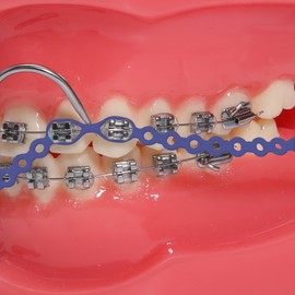 faruijie Colourful Elastic Power Chain for Braces Dental Orthodontic Powerchains 3 Sizes Ortho Rubber Band(Short,Purple 16#)