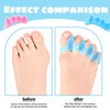 LUMOOM 4 Stück Zehenseparatoren, Hallux Valgus Korrektur, Wiederverwendbare und Waschbare