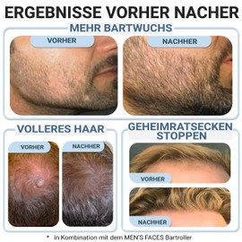 Bart & Haarwachstum Serum für mehr Bartwuchs & Haar für Männer – speziell für Beard Roller & Dermaroller – Jetzt Wachstum beschleunigen mit der Bartpflege von MEN’S FACES – 50 ml