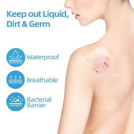 Jointown Transparent Film Dressing, Waterproof Adhesive Clear Wound Cover Bandage, Wound Seal for Post Surgical, Scar Therapy, Tattoo Dressings，2.37 x 2.75 inches 100 Packs