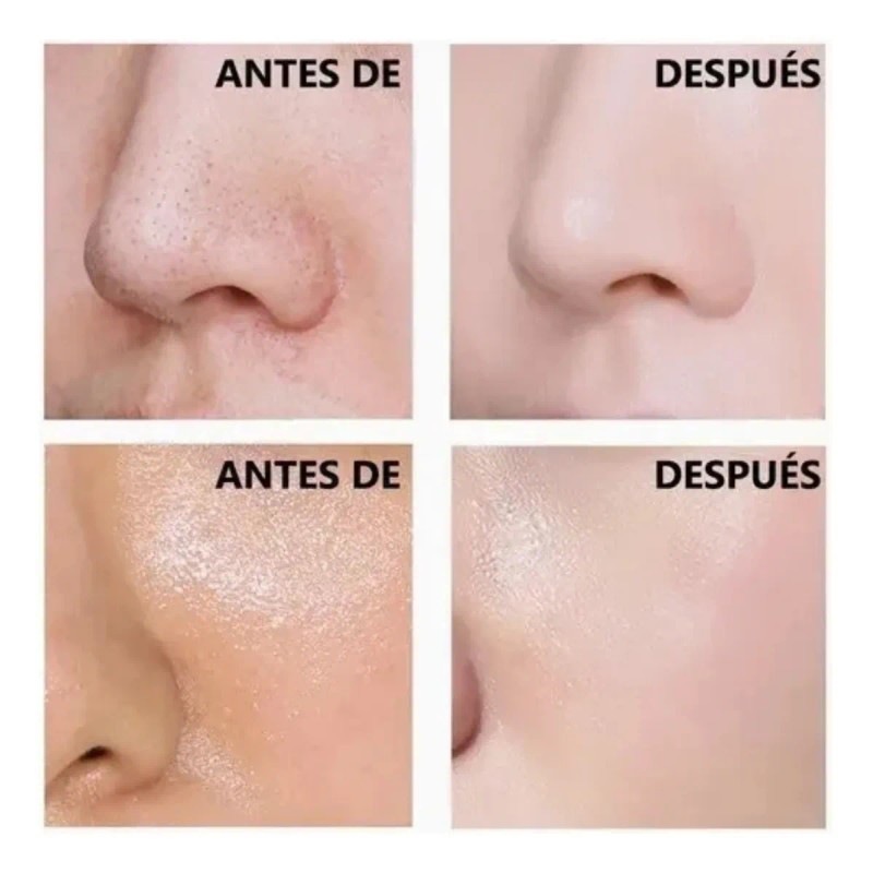 24 Jabones De Arroz Quita Manchas, Aclara, Suaviza, Mc Life.