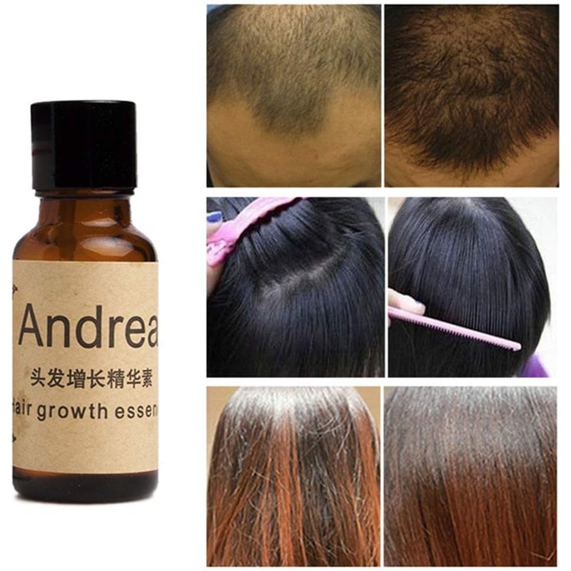 Andrea Hair Growth Essence Hair Loss Treatment ginger Sunburst raise