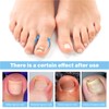 50 Pcs No Glue Breathable Corrector Patch,Painless ingrown toenail Corrector,Nail