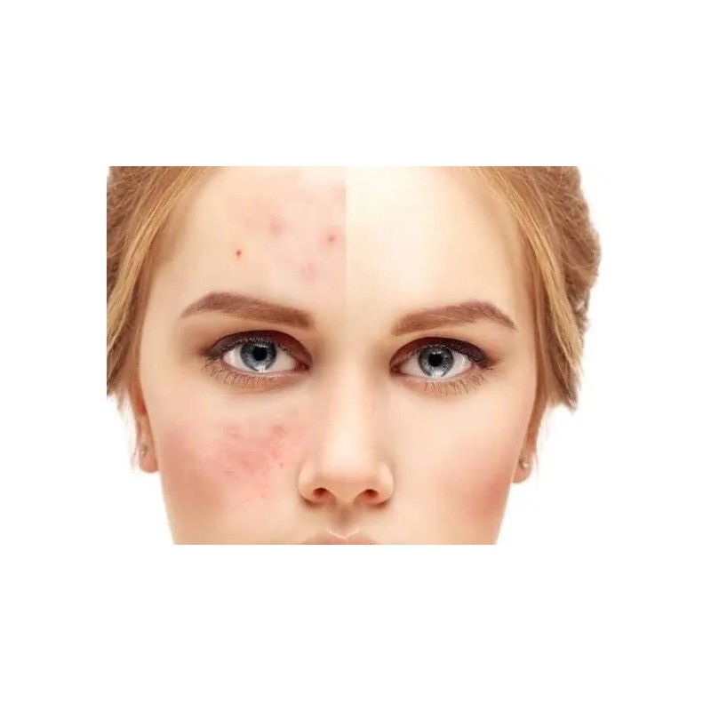 Tonico Concentrado Antiedad Arruga Manchas Repara Cutis Cara Normal Día/noche