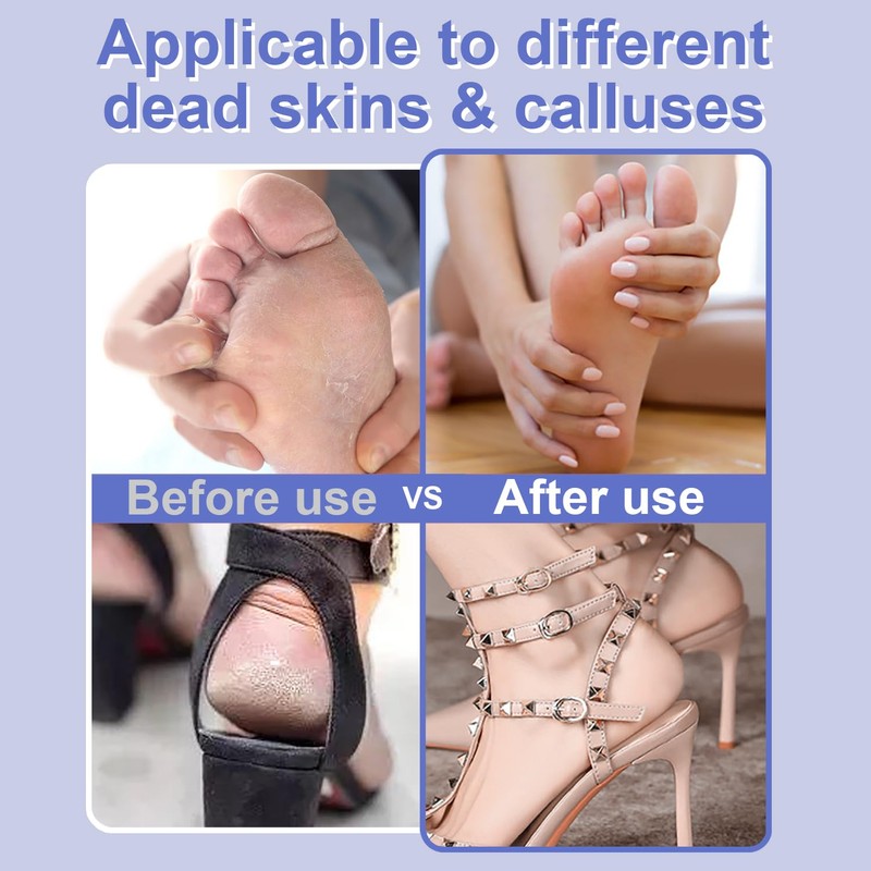 HayZBao Electric Foot File - High Torque,Callus Remover for Feet,Adjustable