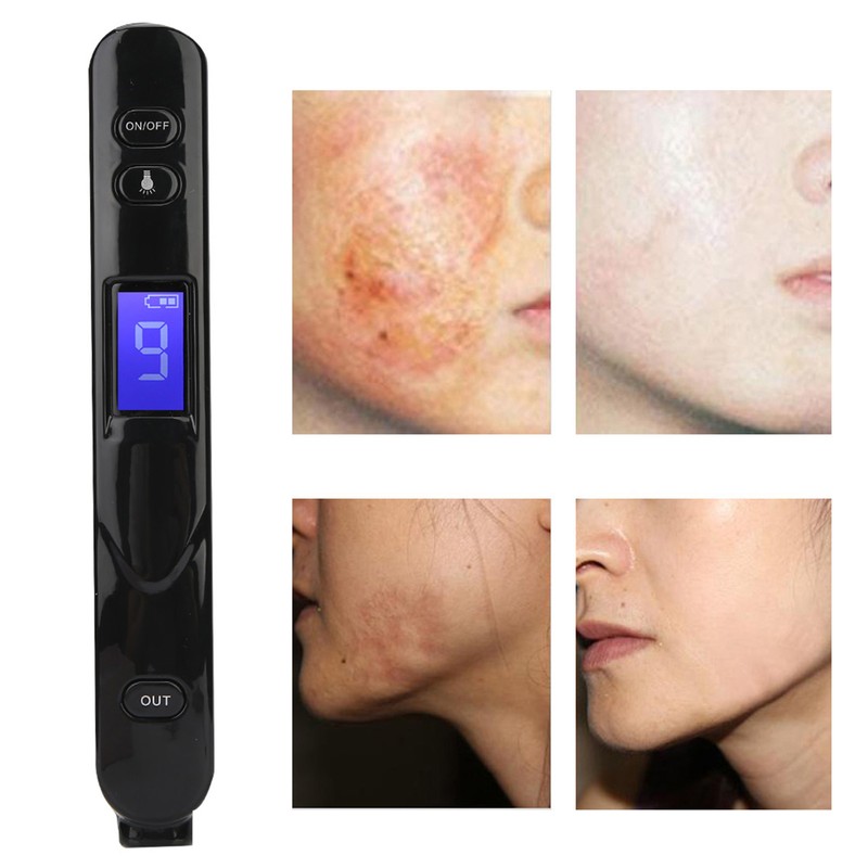 9 Modes Adjustable Tattoo Scar Spot Freckle Removal Pen Skin