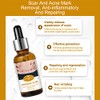 Aichun Beauty Células de reparación de aceite esencial compuesto premium