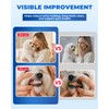 PATWING Ultrasonic Dog Tooth Cleaner, Plaque & Tartar Remover for