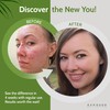 Exposed Skin Care Probiotic Supplement Complex with 1 Billion CFU
