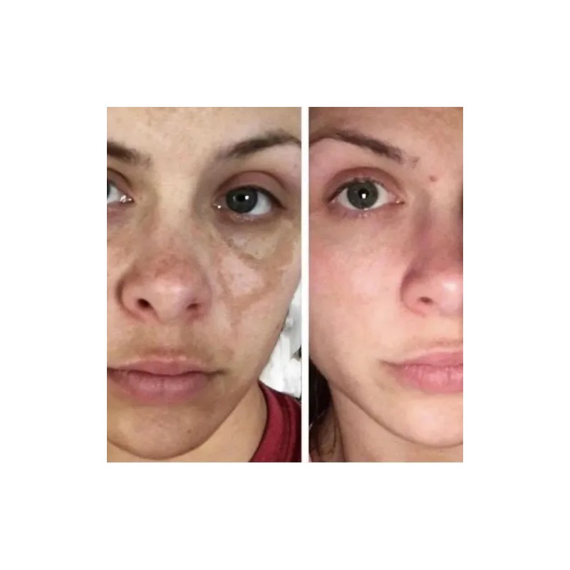 Crema Carotone 135 Ml Antimanchas Cutis Limpio