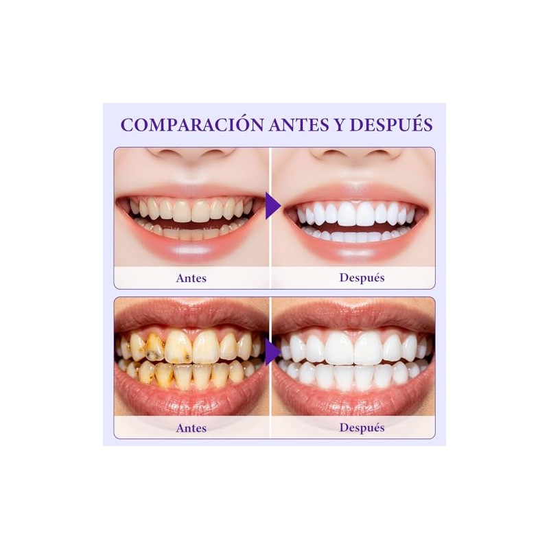 7 Pares 14 Unidades,Purple Teeth Whitening Strips, Tiras Blanqueadoras De