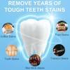 Tiras Blanqueadoras Dentales Sesiones Elimina Manchas Café Tratamiento Días Fórmula