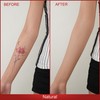 ANJOROUSA Body Coverage Perfector - Tattoo Cover Up Makeup,Body Foundation,Waterproof