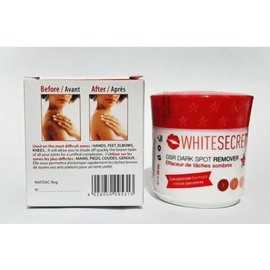 White Secret Face Cream DSR Spot Remover for Lightening Concentrate Formula (Pack of 1)
