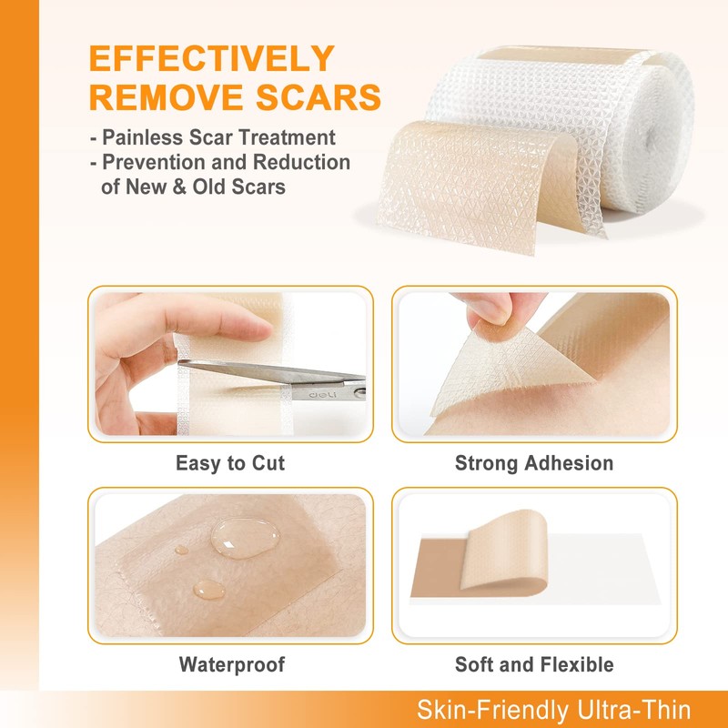 Carbou Silicone Scar Sheets (1.6"x 60"Roll) Medical Silicone Scar Tape
